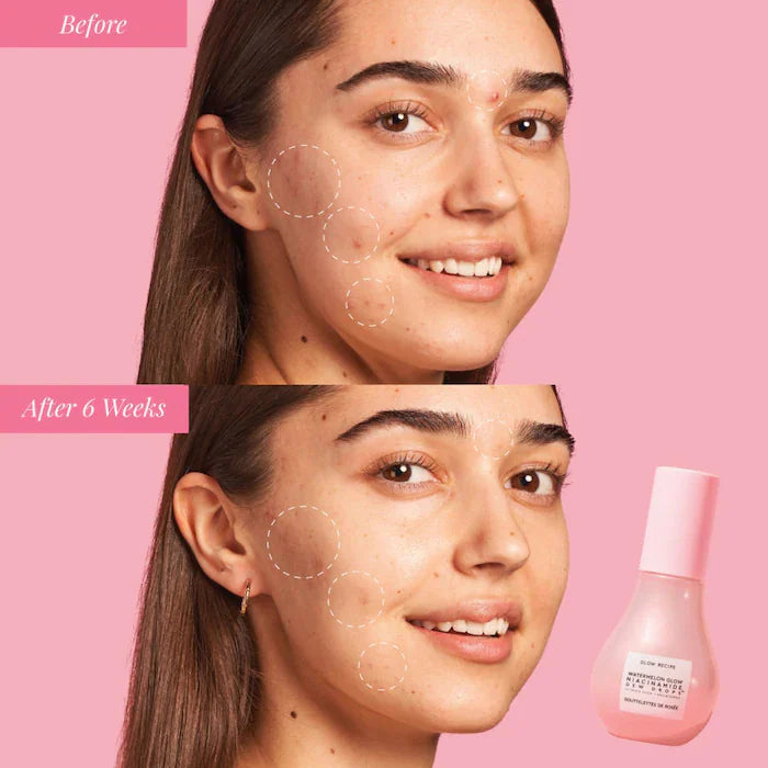 Sephora Favorites
The Glow Up Kit